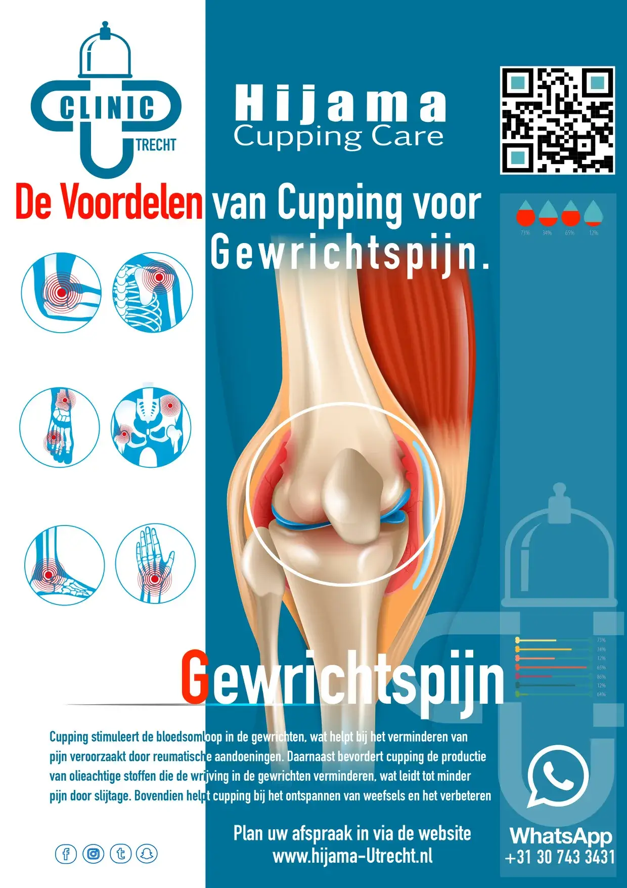 Gewrichtspijn