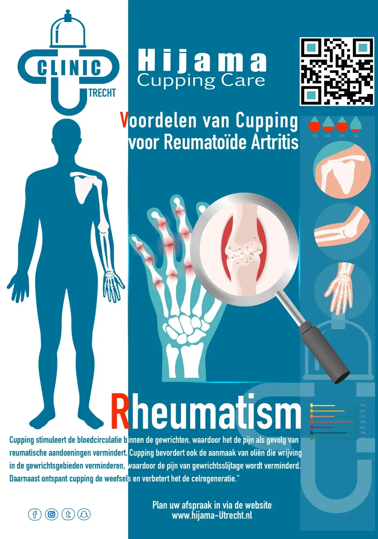 Reuma