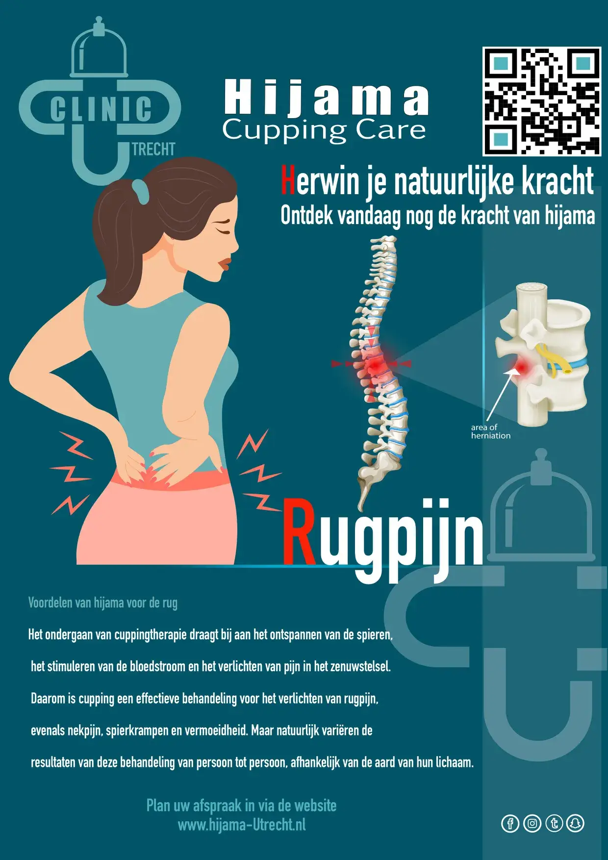 Rugpijn